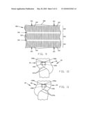 DISPOSABLE ABSORBENT ARTICLE HAVING DUAL LAYER BARRIER CUFF STRIPS diagram and image