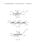 DISPOSABLE ABSORBENT ARTICLE HAVING DUAL LAYER BARRIER CUFF STRIPS diagram and image