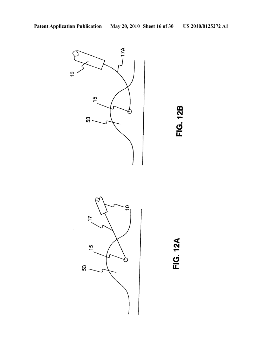 Endoscopic Devices And Related Methods Of Use - diagram, schematic, and image 17