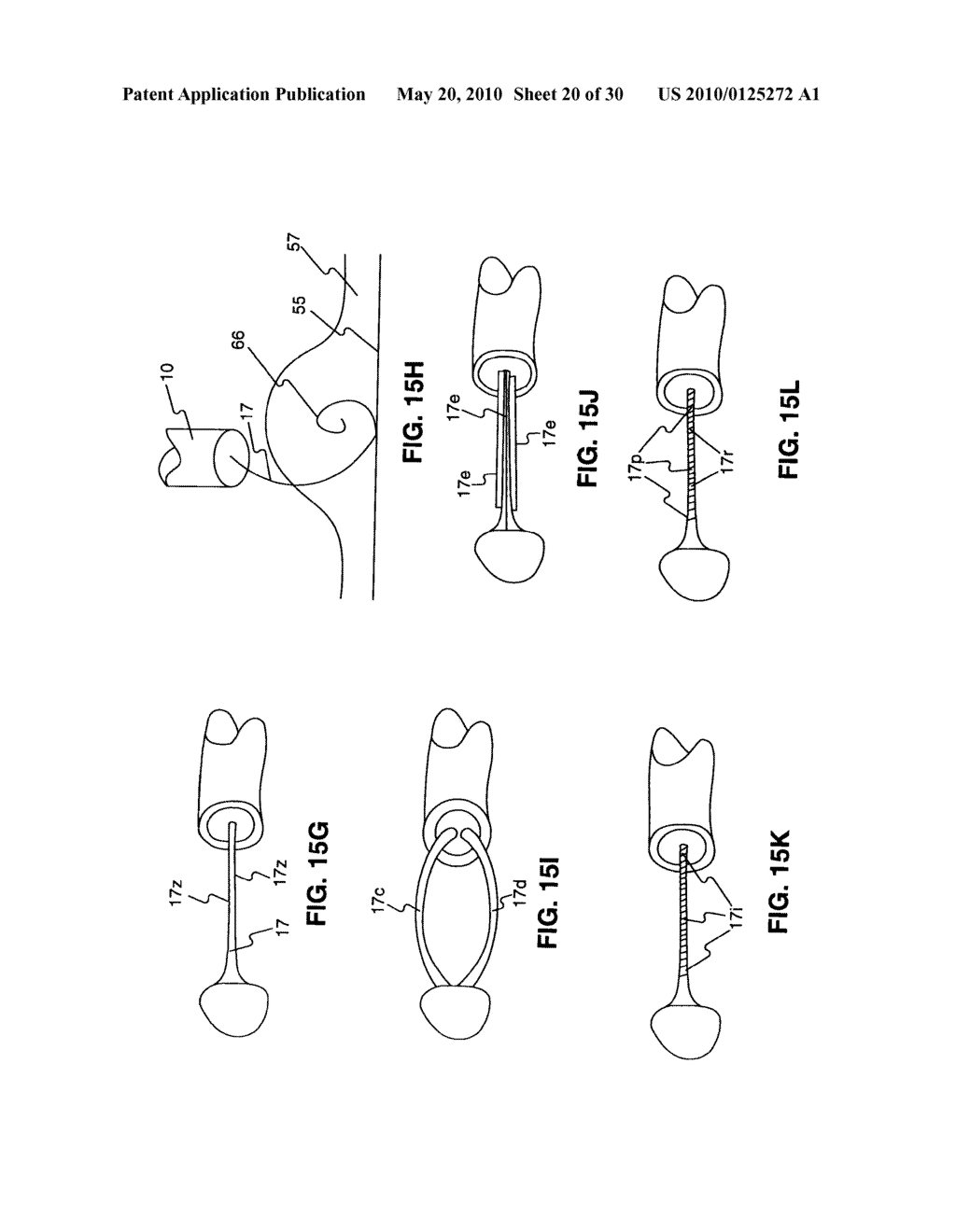 Endoscopic Devices And Related Methods Of Use - diagram, schematic, and image 21