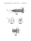 Hard and Soft Tip Intraocular Lens Injector System and Method diagram and image