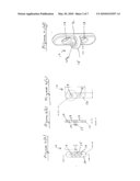 AC JOINT REPAIR USING SUTURE BUTTON GRAFT CONSTRUCT AND METHOD OF SURGERY diagram and image