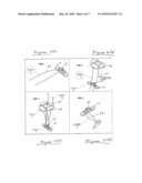 AC JOINT REPAIR USING SUTURE BUTTON GRAFT CONSTRUCT AND METHOD OF SURGERY diagram and image