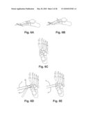 SURGICAL DEVICE, SYSTEM AND METHOD OF USE THEREOF diagram and image