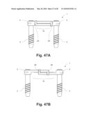 SURGICAL DEVICE, SYSTEM AND METHOD OF USE THEREOF diagram and image