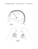 SATELLITE THERAPY DELIVERY SYSTEM FOR BRAIN NEUROMODULATION diagram and image