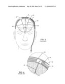 SATELLITE THERAPY DELIVERY SYSTEM FOR BRAIN NEUROMODULATION diagram and image