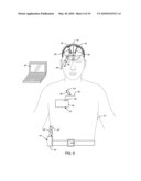 SATELLITE THERAPY DELIVERY SYSTEM FOR BRAIN NEUROMODULATION diagram and image