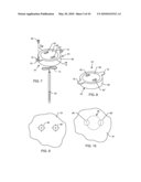 SATELLITE THERAPY DELIVERY SYSTEM FOR BRAIN NEUROMODULATION diagram and image