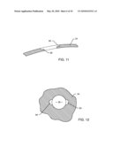 SATELLITE THERAPY DELIVERY SYSTEM FOR BRAIN NEUROMODULATION diagram and image