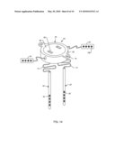 SATELLITE THERAPY DELIVERY SYSTEM FOR BRAIN NEUROMODULATION diagram and image