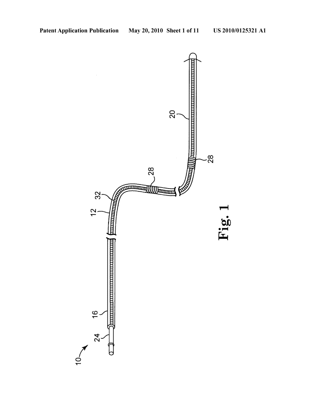 EPTFE FILL OF COIL FILAR GAPS - diagram, schematic, and image 02