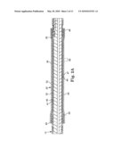 EPTFE FILL OF COIL FILAR GAPS diagram and image