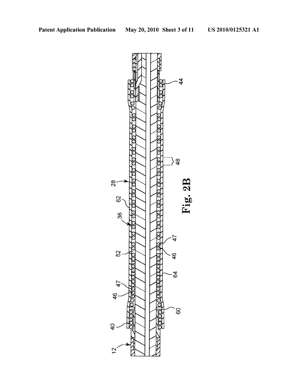 EPTFE FILL OF COIL FILAR GAPS - diagram, schematic, and image 04