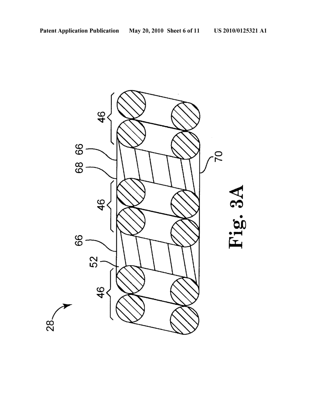 EPTFE FILL OF COIL FILAR GAPS - diagram, schematic, and image 07