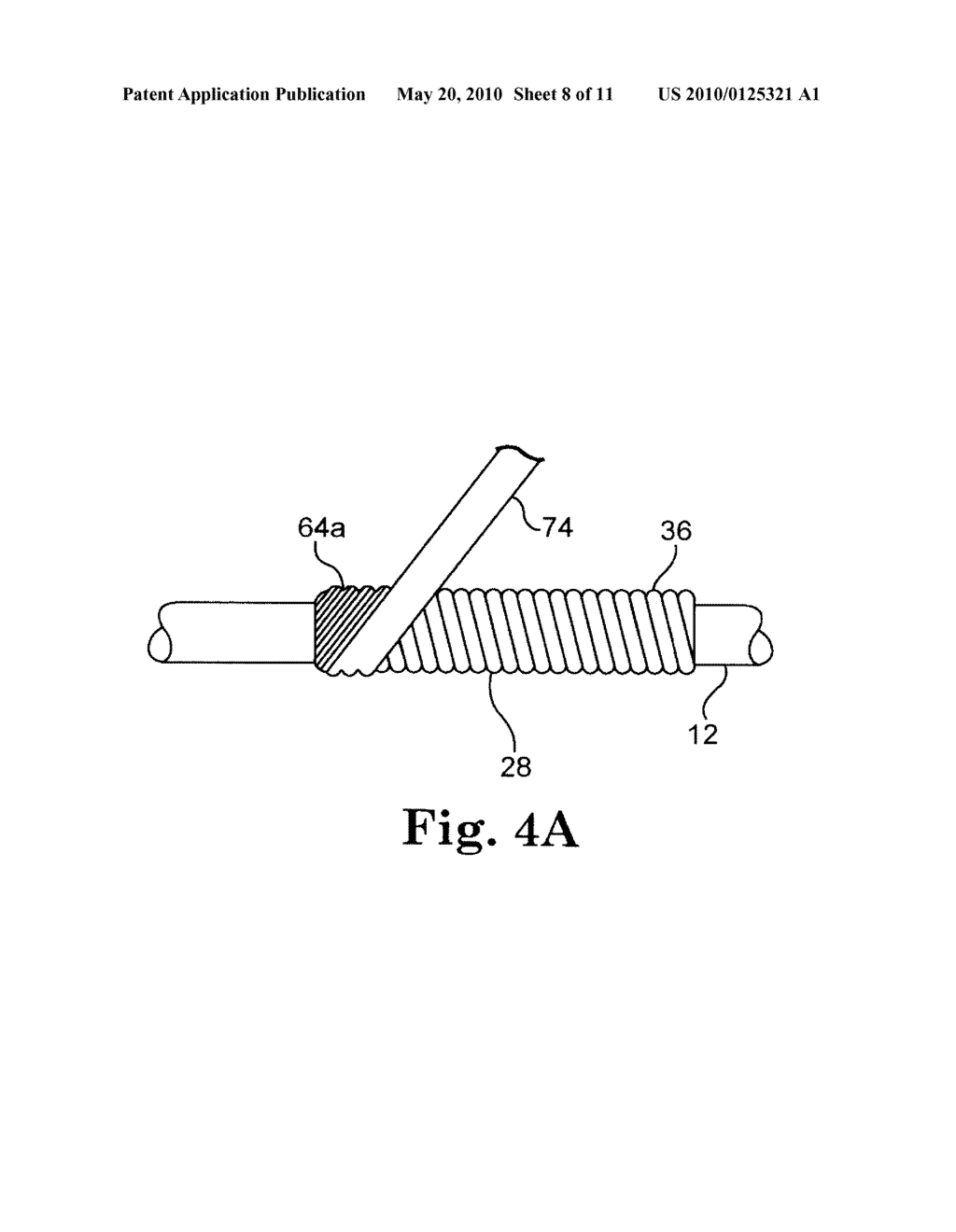 EPTFE FILL OF COIL FILAR GAPS - diagram, schematic, and image 09