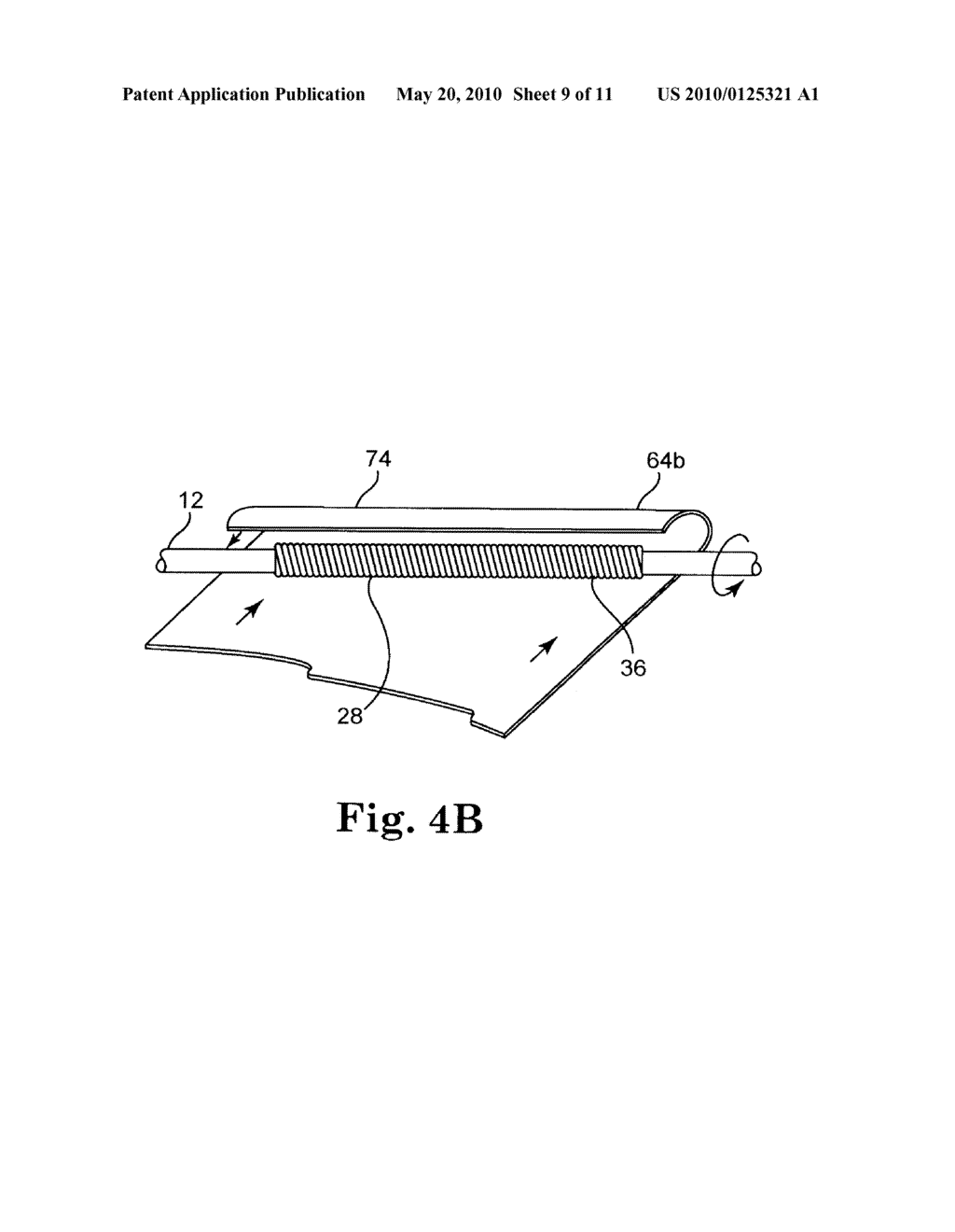 EPTFE FILL OF COIL FILAR GAPS - diagram, schematic, and image 10