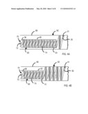 Coil Stent Delivery System and Method of Use diagram and image