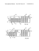 Coil Stent Delivery System and Method of Use diagram and image