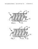 Coil Stent Delivery System and Method of Use diagram and image