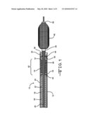 EXCHANGEABLE DELIVERY SYSTEM WITH DISTAL PROTECTION diagram and image