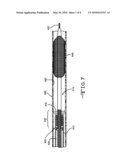 EXCHANGEABLE DELIVERY SYSTEM WITH DISTAL PROTECTION diagram and image