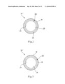 BIOABSORBABLE STENT diagram and image