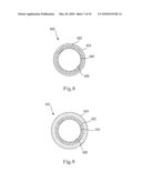 BIOABSORBABLE STENT diagram and image