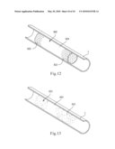 BIOABSORBABLE STENT diagram and image