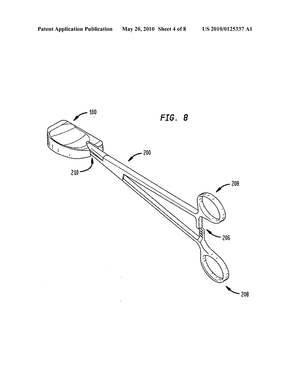 Trial implant and method of use - diagram, schematic, and image 05