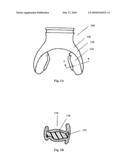 Antimicrobial dental appliances diagram and image