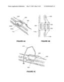 CONTAINMENT DEVICE, METHOD AND SYSTEM diagram and image