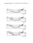 IN SITU RECOVERY FROM A HYDROCARBON CONTAINING FORMATION diagram and image