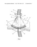 Sealing Assembly diagram and image