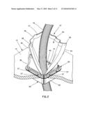 Sealing Assembly diagram and image