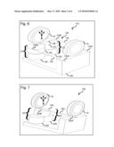 Optical Package Comprising an Adjustable Lens Component Coupled to a Multi-Directional Lens Flexure diagram and image