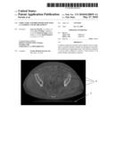 Structure and Procedure for X-Ray CT Guided Cancer Treatment diagram and image