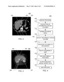 SYSTEMS, APPARATUS AND PROCESSES FOR AUTOMATED MEDICAL IMAGE SEGMENTATION USING A STATISTICAL MODEL diagram and image