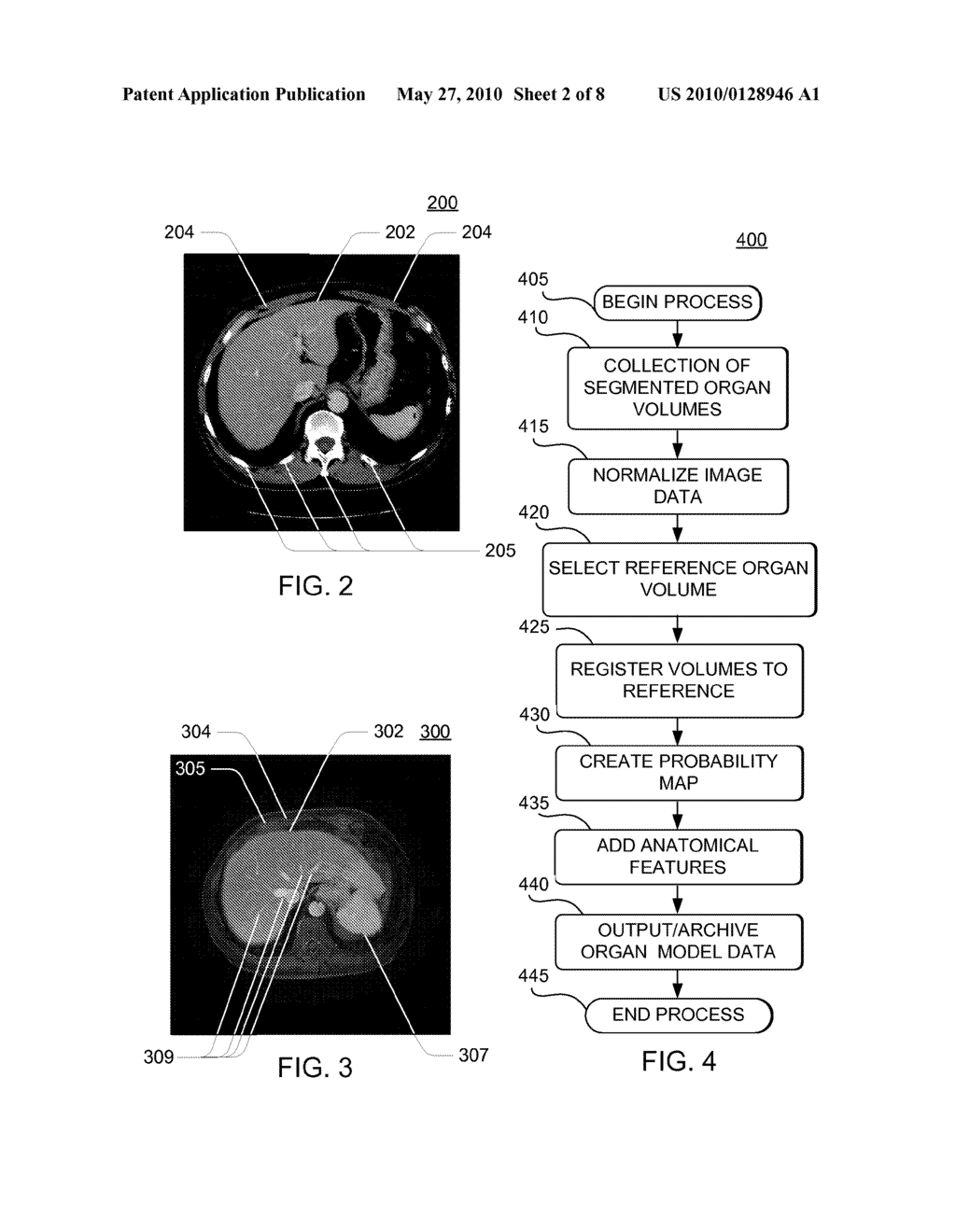 SYSTEMS, APPARATUS AND PROCESSES FOR AUTOMATED MEDICAL IMAGE SEGMENTATION USING A STATISTICAL MODEL - diagram, schematic, and image 03