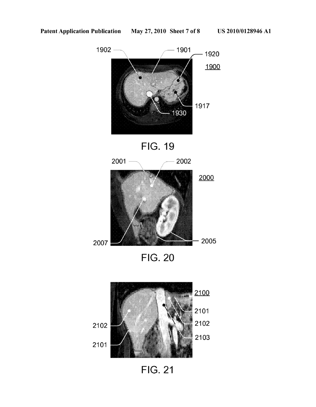 SYSTEMS, APPARATUS AND PROCESSES FOR AUTOMATED MEDICAL IMAGE SEGMENTATION USING A STATISTICAL MODEL - diagram, schematic, and image 08