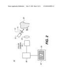 METHOD FOR DETECTION OF CARIES diagram and image