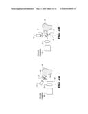 METHOD FOR DETECTION OF CARIES diagram and image