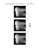 METHOD FOR DETECTION OF CARIES diagram and image