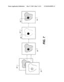 METHOD FOR DETECTION OF CARIES diagram and image