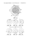 COMPRESSION METHOD AND MEANS diagram and image