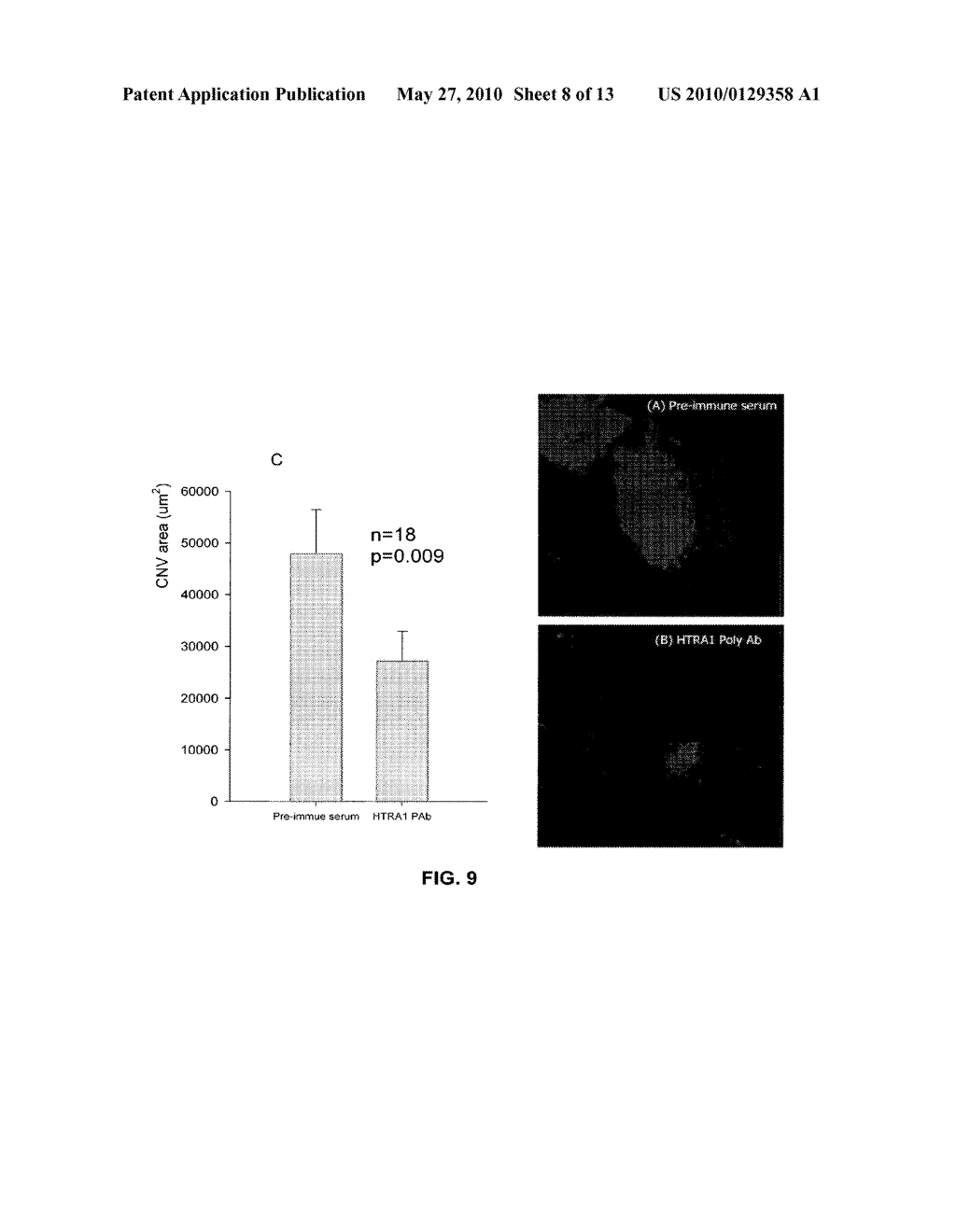 METHOD OF DETECTING OCULAR DISEASES AND PATHOLOGIC CONDITIONS AND TREATMENT OF SAME - diagram, schematic, and image 09