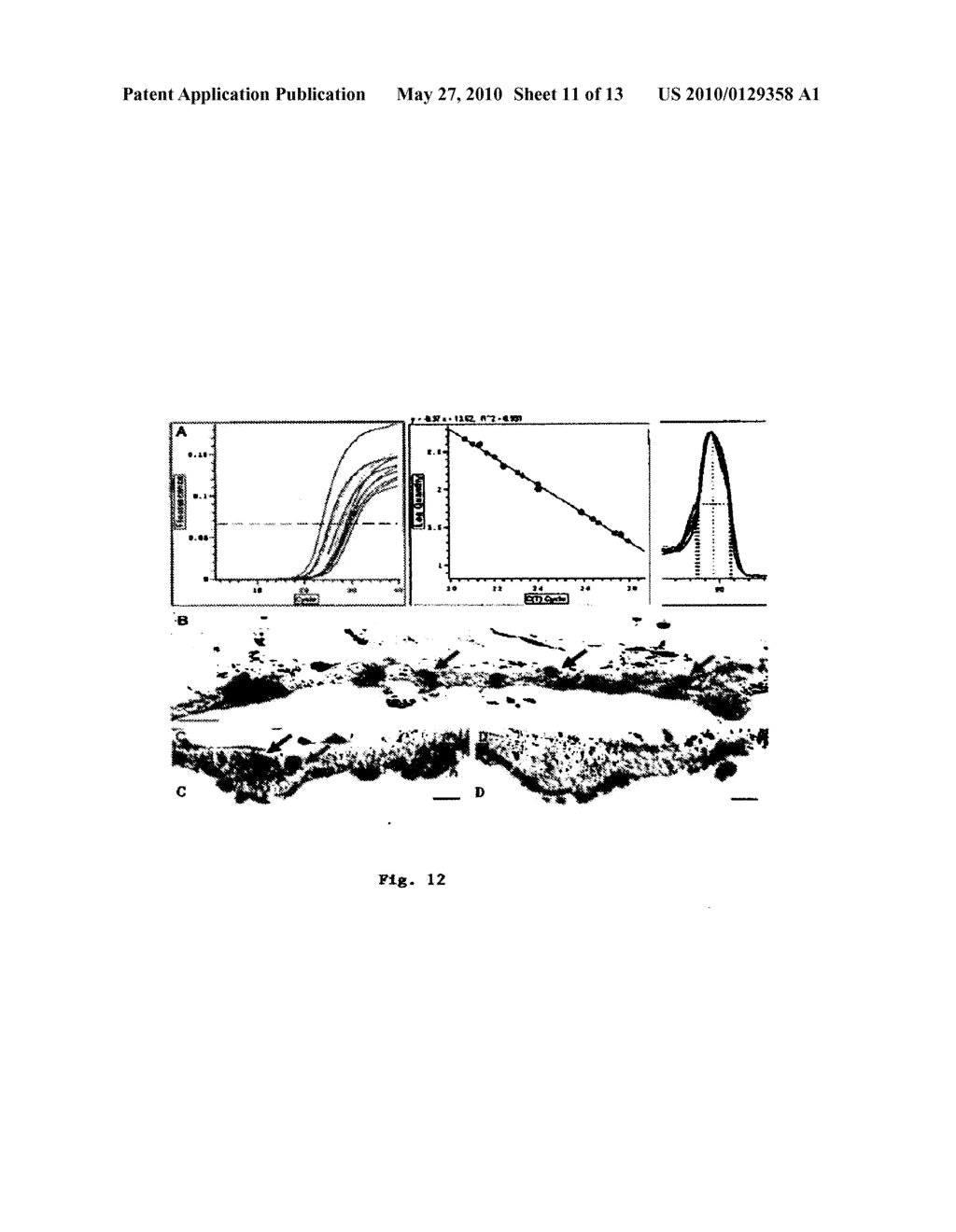 METHOD OF DETECTING OCULAR DISEASES AND PATHOLOGIC CONDITIONS AND TREATMENT OF SAME - diagram, schematic, and image 12