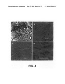 Method for preparing hydro/organo gelators from disaccharide sugars by biocatalysis and their use in enzyme-triggered drug delivery diagram and image