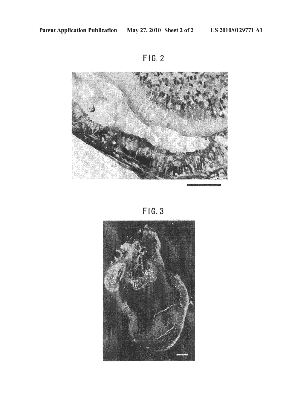 METHOD FOR PRODUCTION OF TOOTH, AND TOOTH PRODUCED BY THE METHOD - diagram, schematic, and image 03