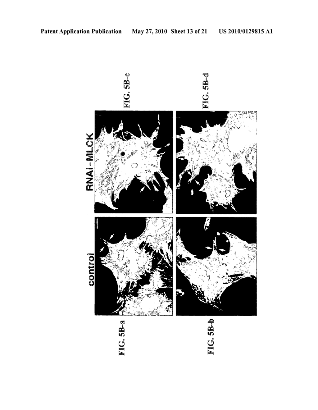 IDENTIFICATION OF CARDIAC SPECIFIC MYOSIN LIGHT CHAIN KINASE - diagram, schematic, and image 14